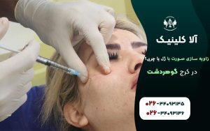 زاویه سازی صورت با ژل بهتر است یا چربی