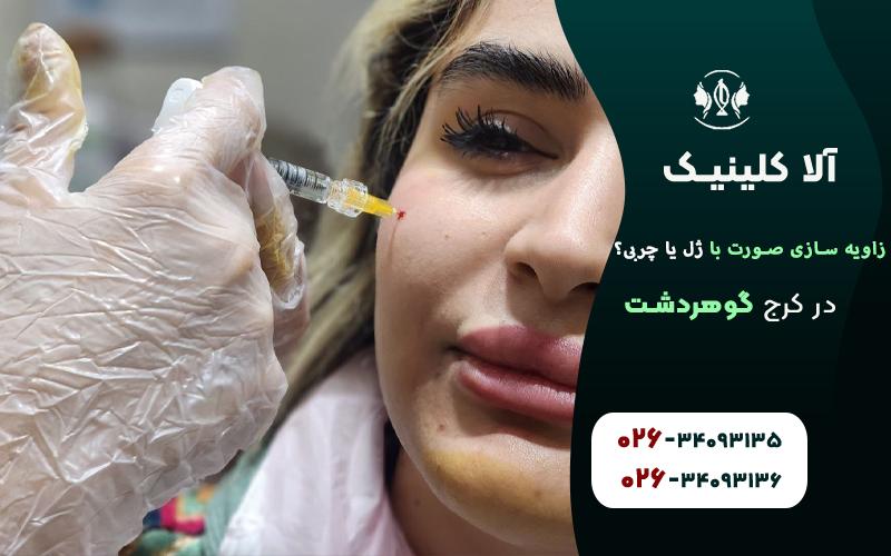 زاویه سازی صورت با ژل بهتر است یا چربی