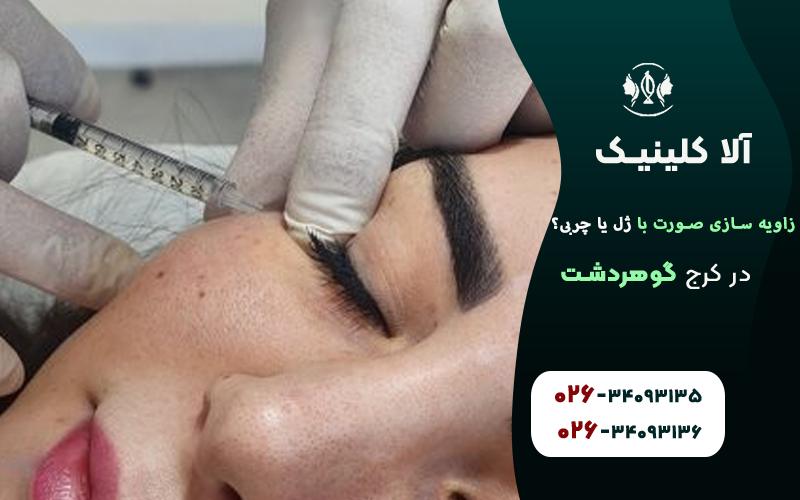 زاویه سازی صورت با ژل بهتر است یا چربی