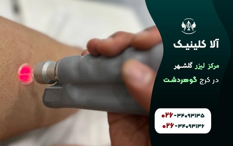 مرکز لیزر گلشهر