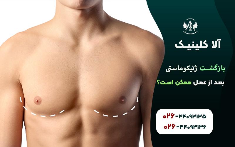 بازگشت ژنیکوماستی بعد از عمل ممکن است