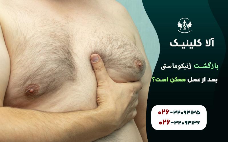 بازگشت ژنیکوماستی بعد از عمل ممکن است