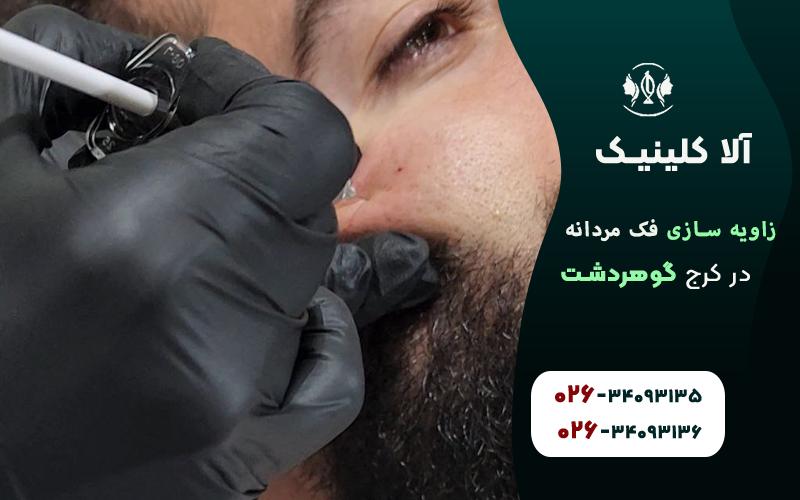 بهترین کلینیک زاویه سازی فک مردانه در کرج