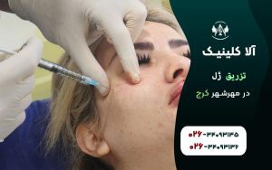تزریق ژل در مهرشهر کرج