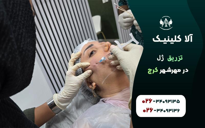 تزریق ژل در مهرشهر کرج