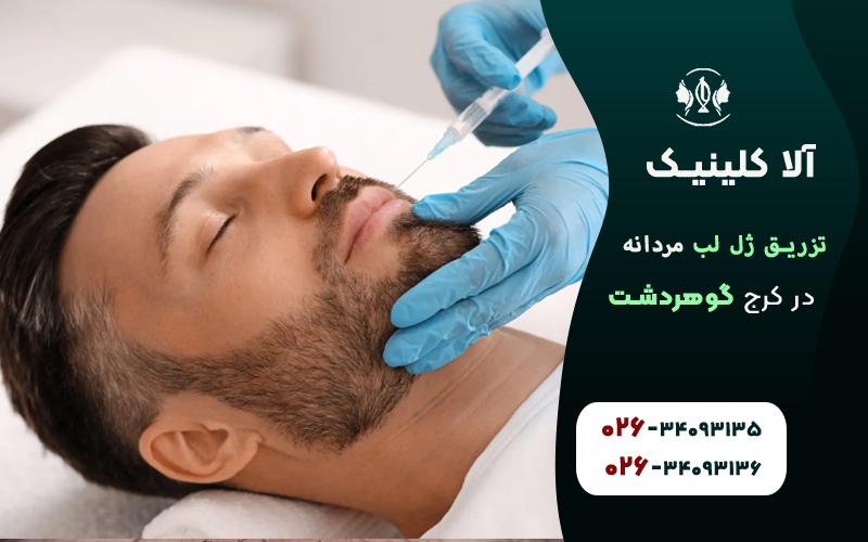 تزریق ژل لب مردانه کرج