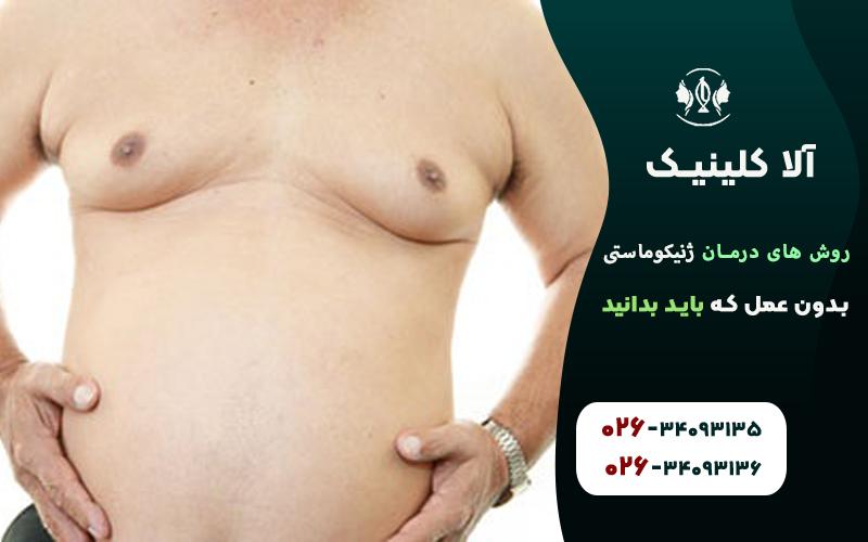 روش های درمان ژنیکوماستی بدون عمل که باید بدانید