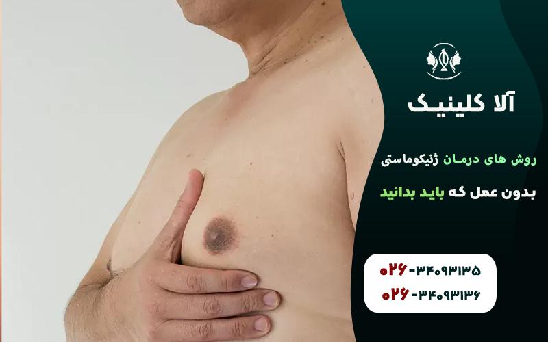 روش های درمان ژنیکوماستی بدون عمل که باید بدانید