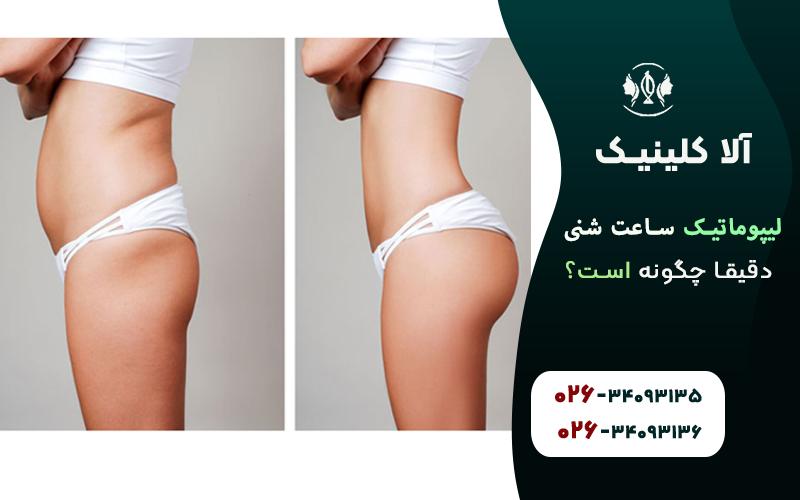 لیپوماتیک ساعت شنی دقیق چگونه است؟