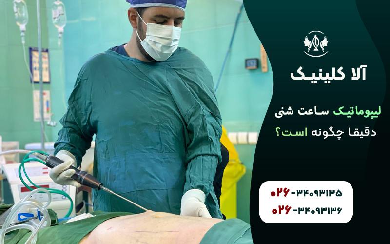 لیپوماتیک ساعت شنی دقیق چگونه است؟