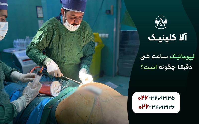 لیپوماتیک ساعت شنی دقیق چگونه است؟
