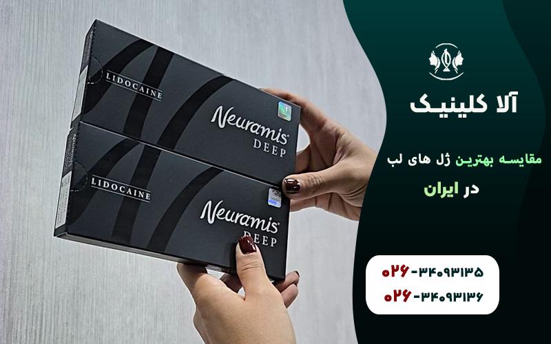 مقایسه بهترین برندهای ژل لب در ایران