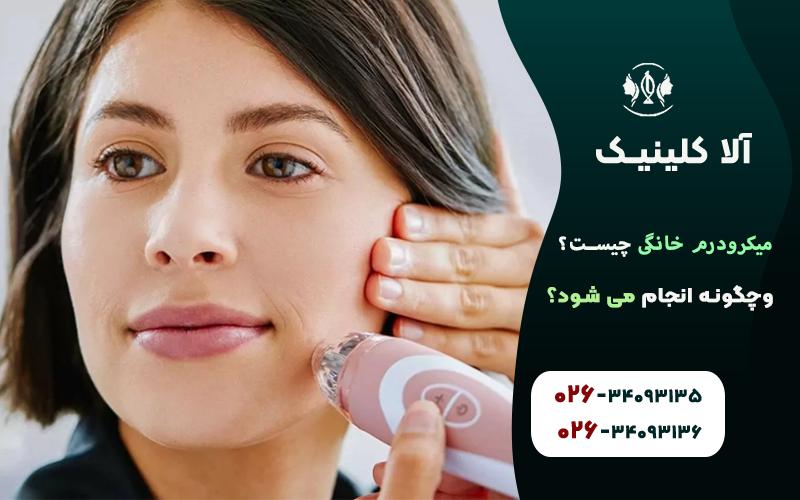 میکرودرم خانگی چیست و چگونه انجام میشود؟