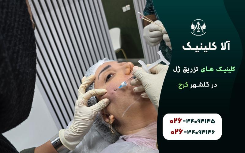 کلینیک های تزریق ژل در گلشهر کرج