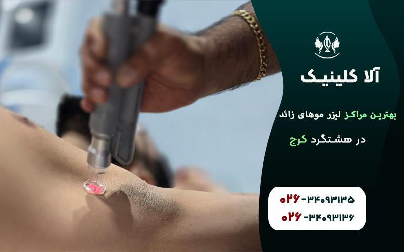 بهترین مراکز لیزر در هشتگرد کرج