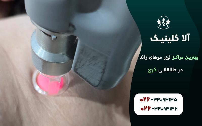 بهترین مراکز لیزر موهای زائد در طالقانی کرج