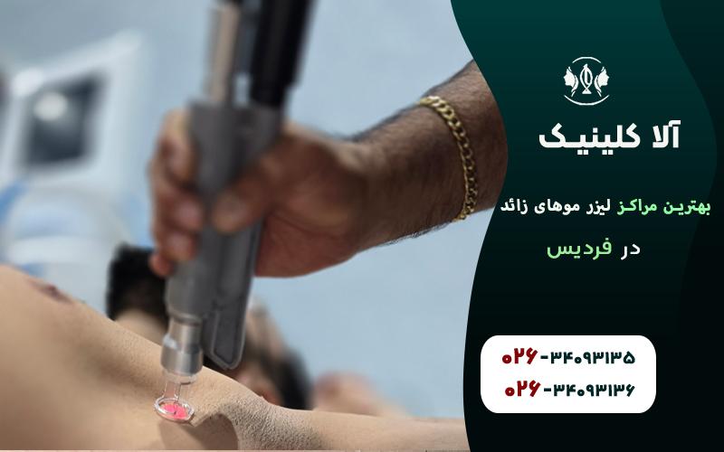بهترین مراکز لیزر موهای زائد در فردیس کرج