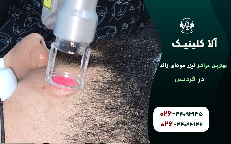 بهترین مراکز لیزر موهای زائد در فردیس