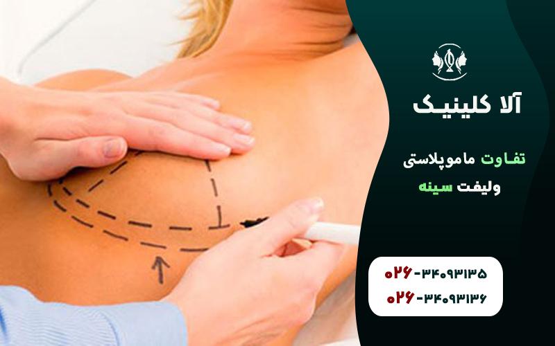 تفاوت ماموپلاستی و لیفت سینه