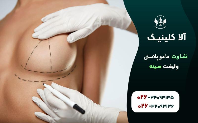 تفاوت ماموپلاستی و لیفت سینه