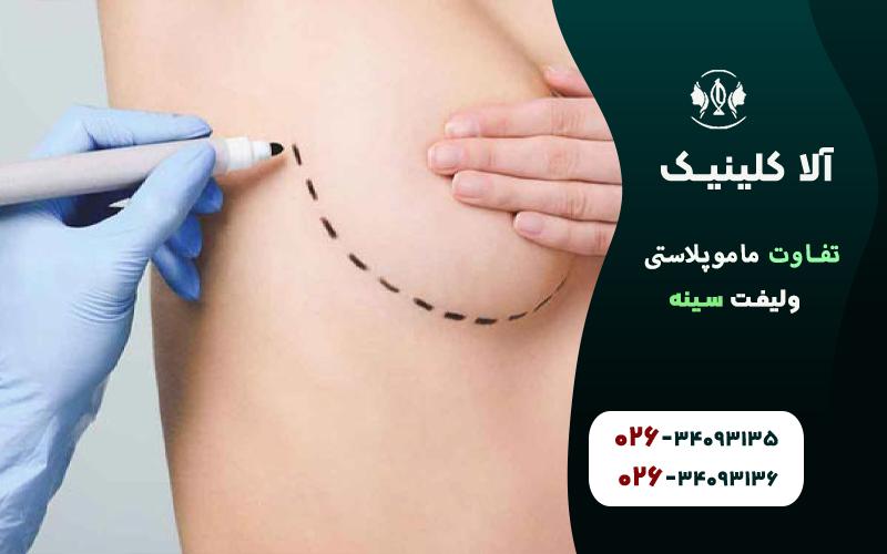 تفاوت ماموپلاستی و لیفت سینه