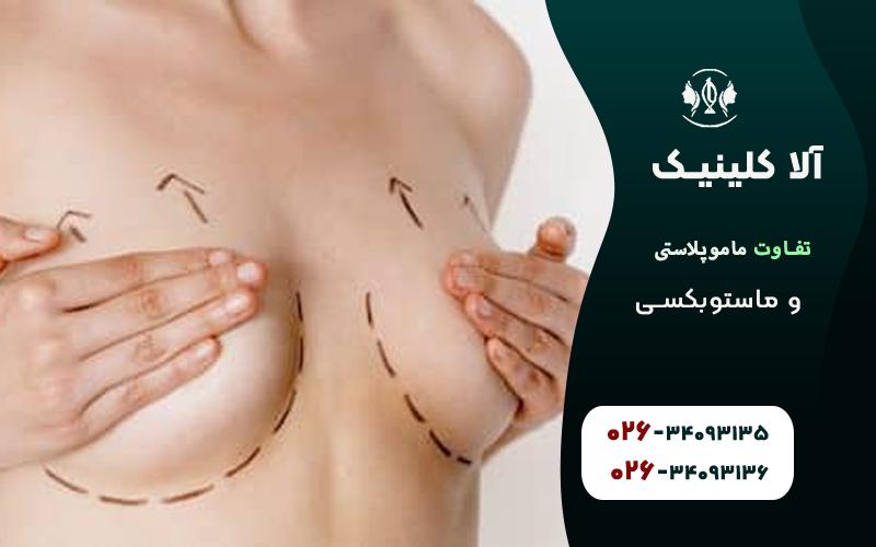 تفاوت ماموپلاستی و ماستوبکسی