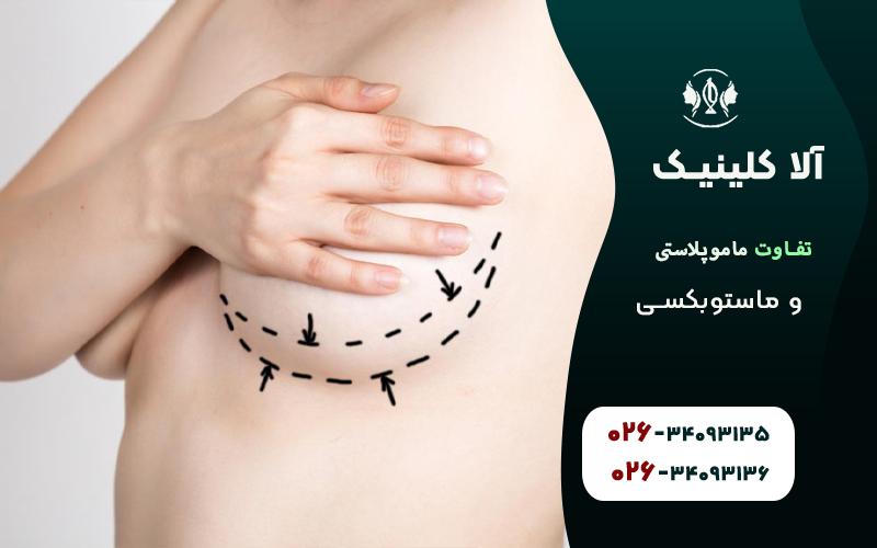 تفاوت ماموپلاستی و ماستوبکسی