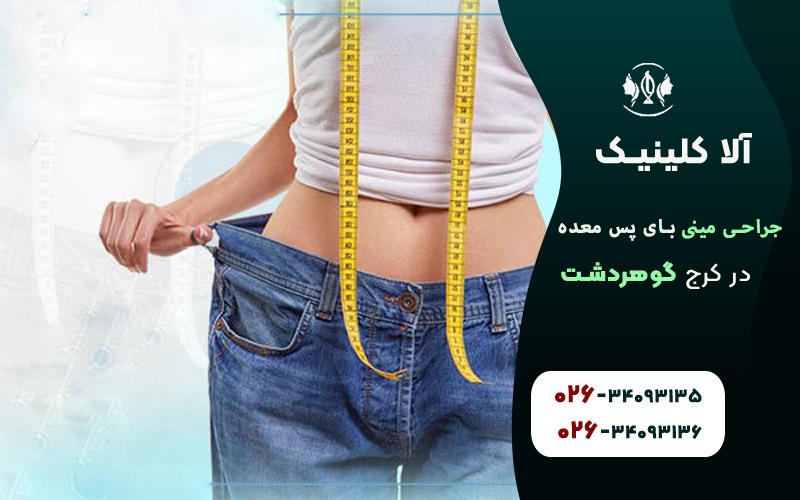 جراحی مینی بای پس معده در کرج