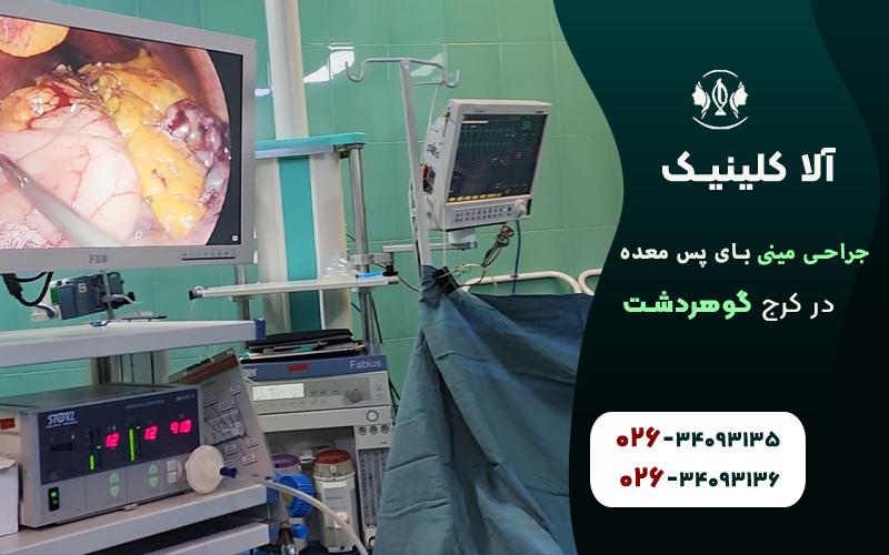جراحی مینی بای پس معده در کرج