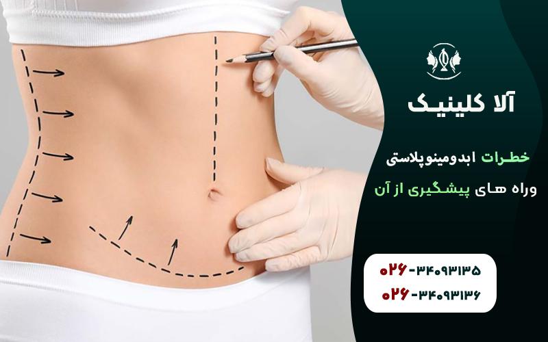 خطرات ابدومینوپلاستی و راه های پیشگیری از آن