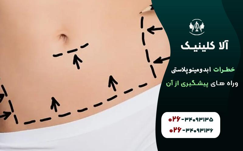 خطرات ابدومینوپلاستی و راه های پیشگیری از آن