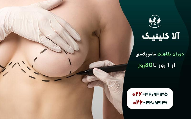 دوره نقاهت ماموپلاستی از یک روز تا 30روز