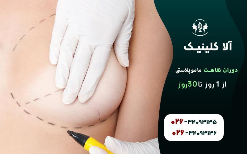 دوره نقاهت ماموپلاستی از یک روز تا 30روز