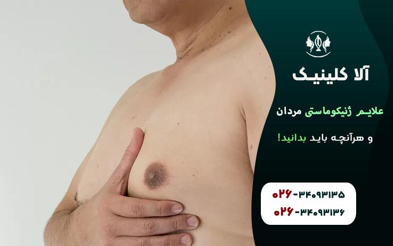 علائم ژنیکوماستی مردان و هرآنچه باید بدانید