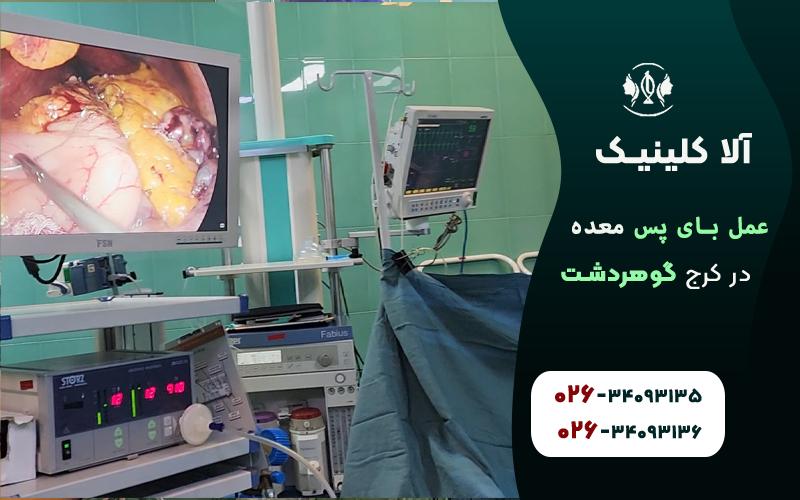 عمل بای پس معده در کرج