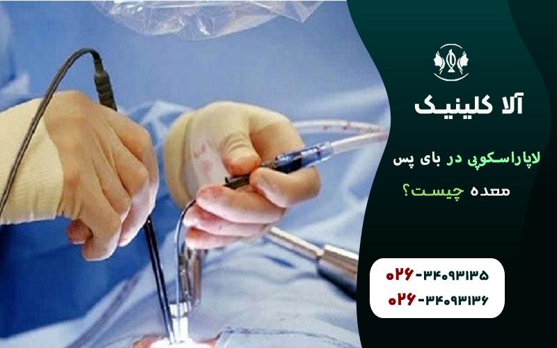 لاپاراسکپی در بای پس معده چیست