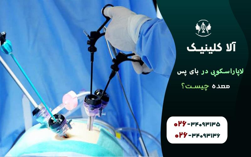 لاپاراسکپی در بای پس معده چیست
