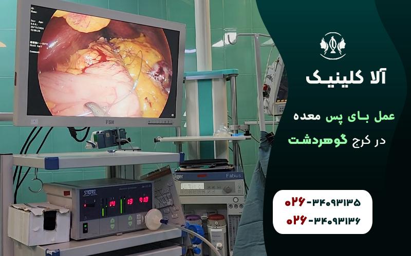 هزینه عمل بای پس معده در کرج