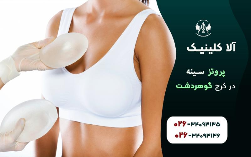 پروتز سینه در کرج