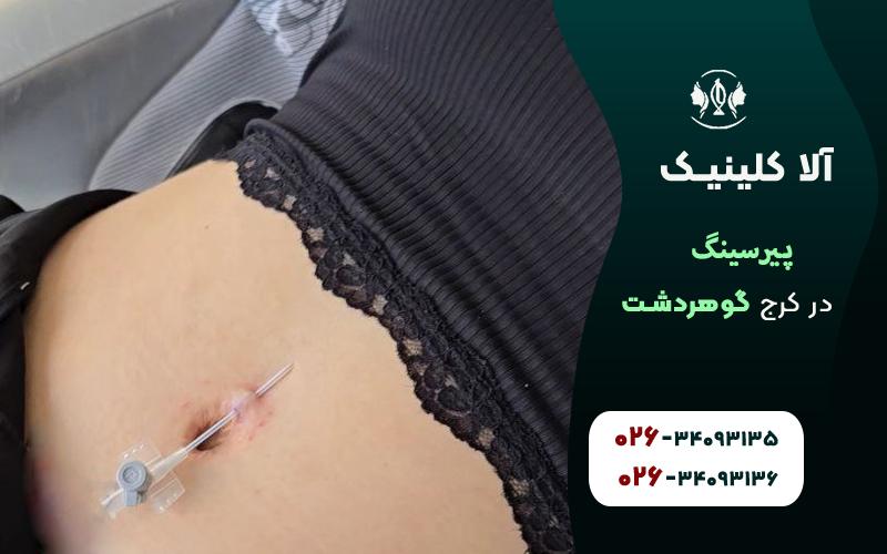 پیرسینگ ناف در کرج