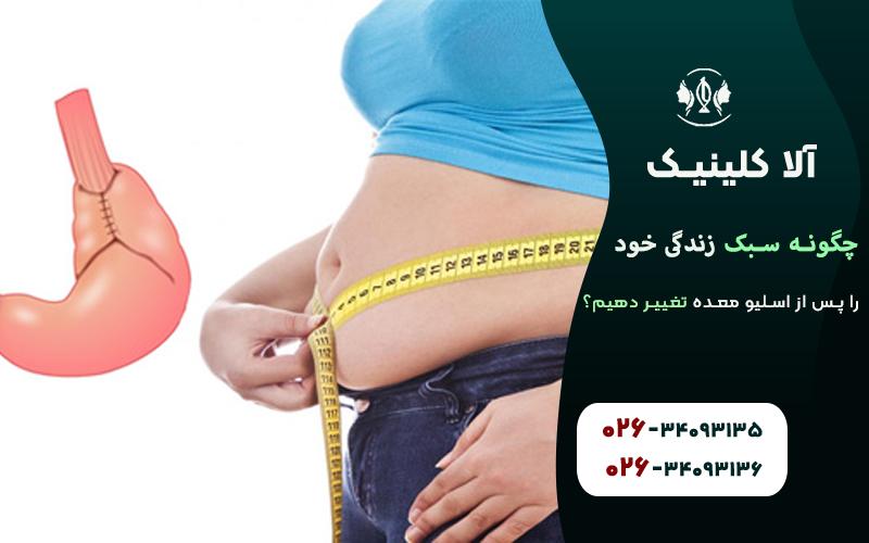 چگونه سبک زندگی خود را پس از اسلیو معده تغییر دهیم