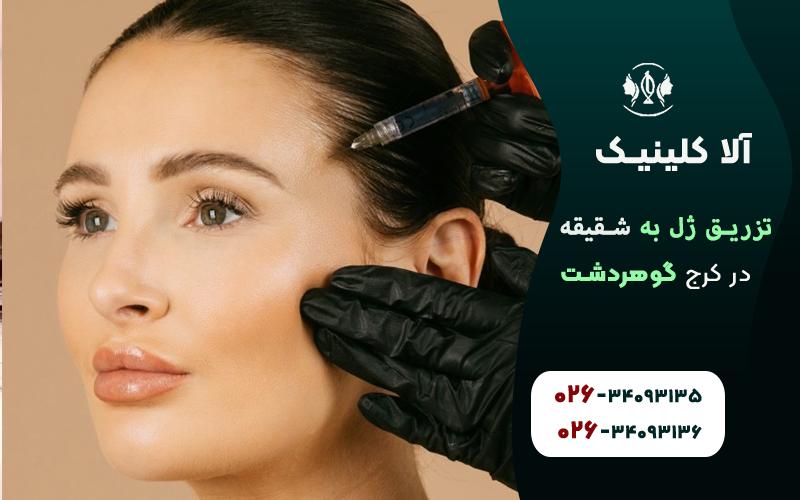 تزریق ژل به شقیقه