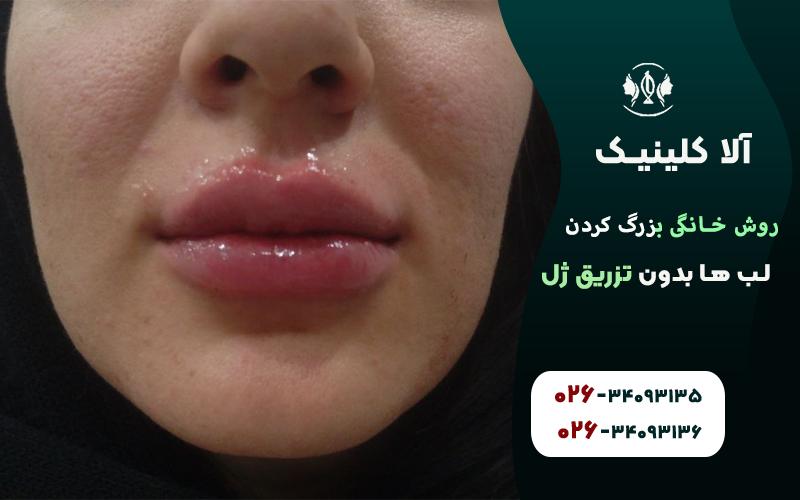 روش خانگی بزرگ کردن لب ها بدون تزریق ژل