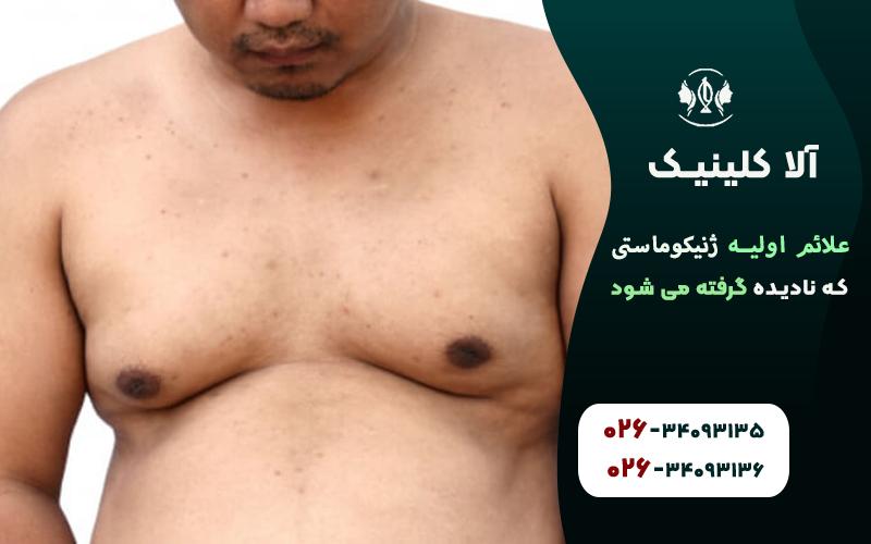 علائم اولیه ژنیکوماستی که نادیده گرفته می شود