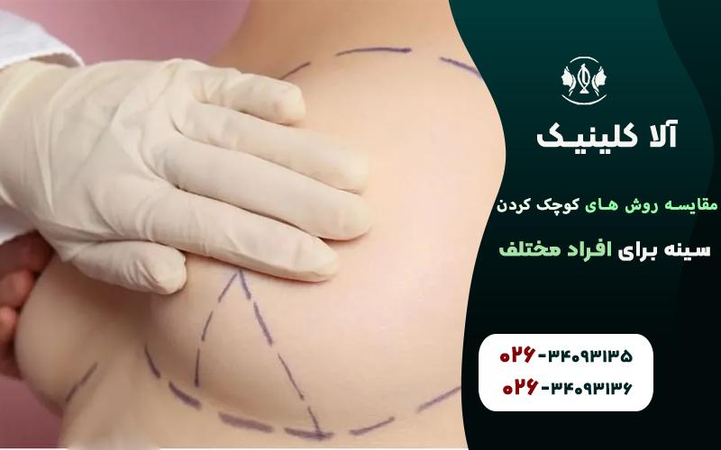 مقایسه روش های کوچک کردن سینه برای افراد مختلف