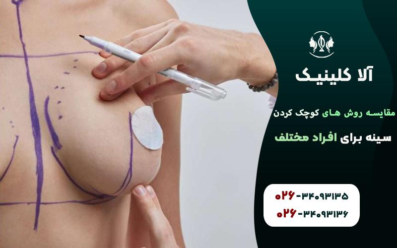 مقایسه روش های کوچک کردن سینه برای افراد مختلف