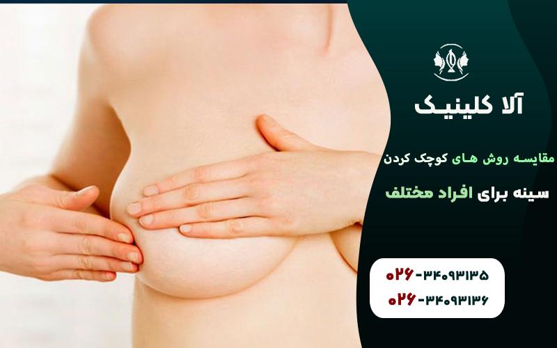 مقایسه روش های کوچک کردن سینه برای افراد مختلف