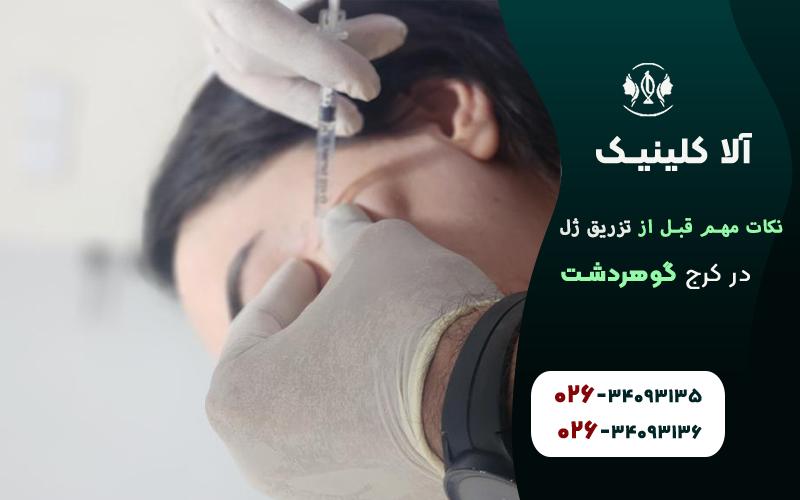 نکات مهم قبل از تزریق ژل که باید بدانید