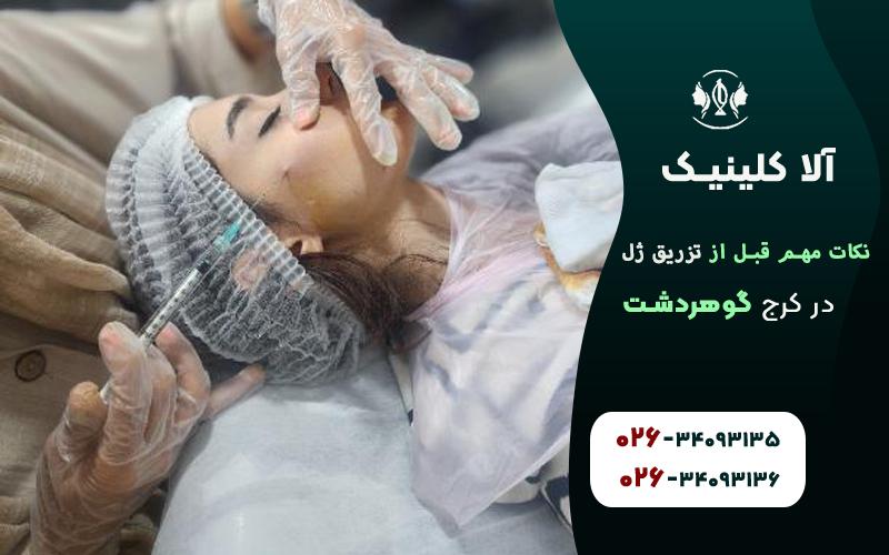 نکات مهم قبل از تزریق ژل که باید بدانید