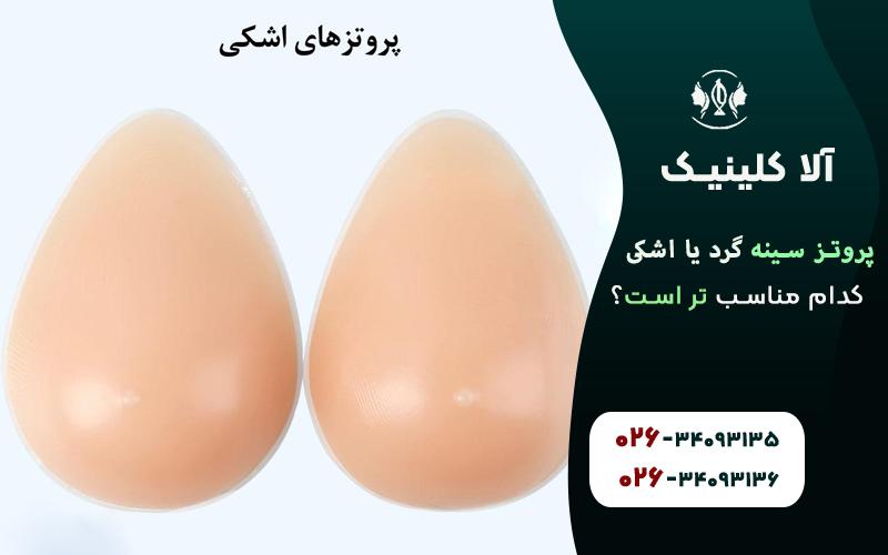 پروتز قطره ای مناسب تر است یا پروتز گرد